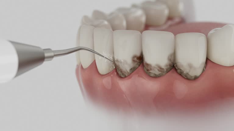 Trusted Dental Implants service in Bristol, VA - Dentist Open Now